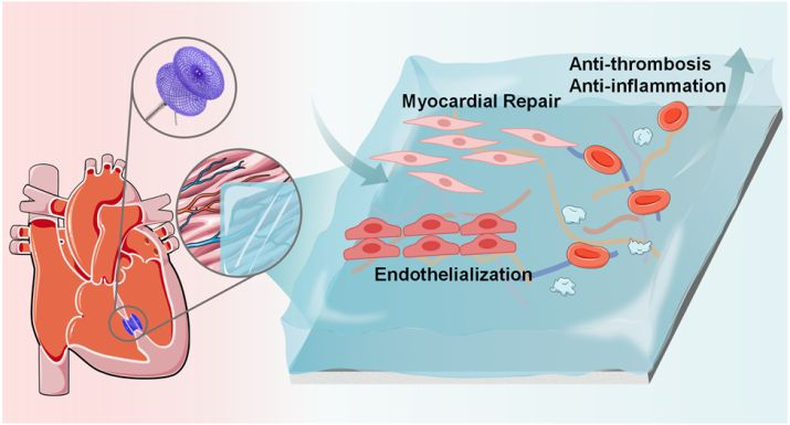 Polyphenol-Reinforced Glycocalyx-Like Hydrogel Coating  Induced Myocardial Regeneration and Immunomodulation